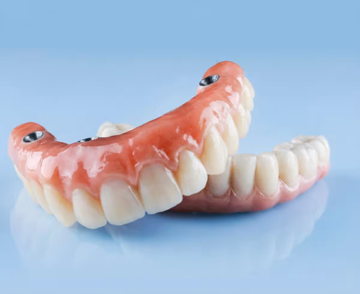 Prótese protocolo superior e inferior parafusada sobre implantes